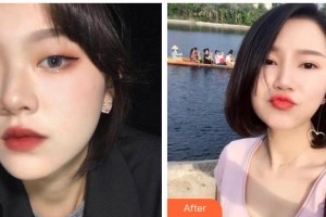 湖南博雅眼科醫(yī)院龔凌整形價格表附眼部綜合案例展示