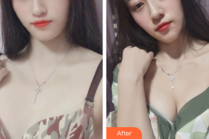 珠海市人民醫(yī)院燒傷整形綜合科張先安整形價格表附自體脂肪隆胸案例展示