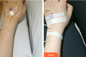 珠海九龍醫(yī)院醫(yī)學美容科傅仙香整形價格表附注射美白案例展示