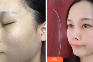 珠海新顏醫(yī)療美容診所何奎整形價格表附激光美膚激光案例展示