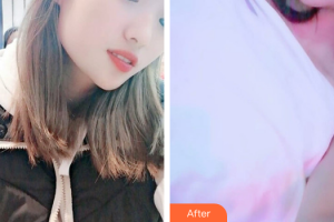 珠海拜博口腔醫(yī)院徐連來整形價格表附超聲波洗牙案例展示