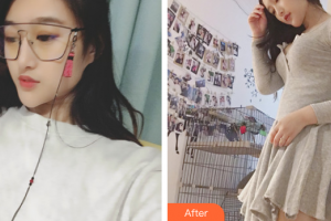 汕頭曙光整形美容醫(yī)院婁潤文整形價格表附微脂豐胸案例展示