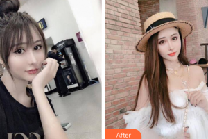 佛山華美整形美容醫(yī)院梁宗建整形價(jià)格表附鼻部手術(shù)案例展示