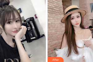 佛山黛顏人醫(yī)療美容門診部黃吉波整形價(jià)格表附鼻部手術(shù)案例展示