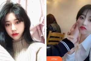 佛山廣美醫(yī)療美容門診部陳佳整形價(jià)格表附鼻翼縮小案例展示