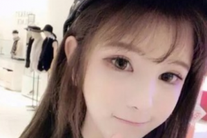 武漢伽美醫(yī)療美容醫(yī)院朱富初整形價(jià)格表附激光點(diǎn)痣案例展示