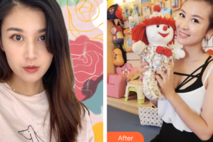 肇慶民和醫(yī)院激光整形科劉雙濤整形價(jià)格表附熱瑪吉案例展示