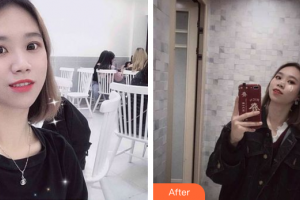 肇慶市皮膚病醫(yī)院醫(yī)療美容科劉珍華整形價(jià)格表附超微小氣泡案例展示