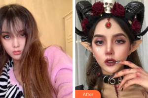 肇慶中大口腔醫(yī)院趙婉寧整形價(jià)格表附冷光美白案例展示