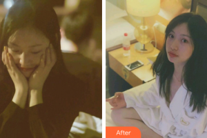 梅州方圓醫(yī)療美容門診部方媛整形價(jià)格表附激光美膚激光案例展示