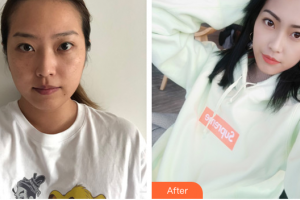 東莞市人民醫(yī)院醫(yī)學美容科陳曉武整形價格表附祛斑祛痣案例展示