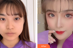 東莞瑞芙臣醫(yī)療美容門診部樸埈奎整形價格表附下頜角磨骨案例展示