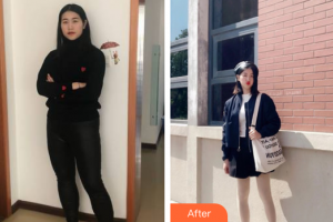 東莞華美醫(yī)療美容醫(yī)院劉潤貴整形價格表附吸脂案例展示