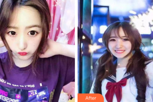 東莞百佳瑪麗亞婦產(chǎn)醫(yī)院馮艷萍整形價格表附果酸換膚案例展示