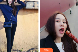 東莞依謀醫(yī)療美容醫(yī)院白大純整形價格表附自體脂肪全臉填充案例展示