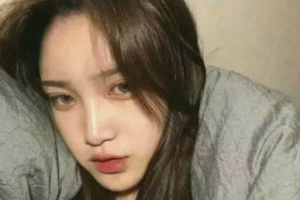 鄭州美緣整形美容醫(yī)院鄧兆龍整形價格表附切開雙眼皮案例展示