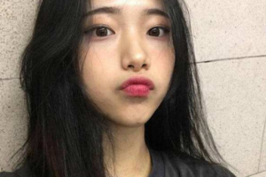 武漢科技大學(xué)附屬天佑醫(yī)院整形美容科李蕓整形價(jià)格表附去痘印痘坑案例展示