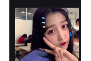 武漢伽美醫(yī)療美容醫(yī)院林孟羲整形價格表附耳軟骨復(fù)合隆鼻案例展示