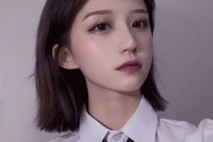 鄭州森德口腔門診部張富英整形價(jià)格表附金屬托槽矯正案例展示