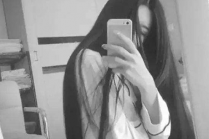 廣東省人民醫(yī)院燒傷整形科瀛整形價(jià)格表附激光祛斑案例展示