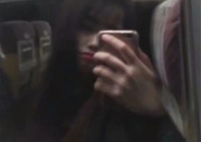 武警廣東總隊(duì)醫(yī)院整形美容中心貝維君整形價(jià)格表附激光祛斑案例展示