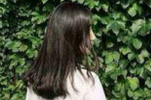 長春醫(yī)美整形美容醫(yī)院樸原辰整形價(jià)格表附埋線提升案例展示