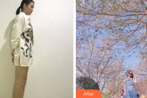 河南整形美容醫(yī)院王合珍整形價(jià)格表附大腿吸脂案例展示