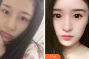 河南省軍區(qū)醫(yī)院激光美容中心張黎整形價(jià)格表附皮膚美容案例展示