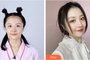 河南省整形美容研究中心宋海林整形價格表附植發(fā)案例展示