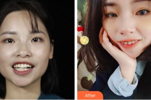 海南口腔醫(yī)院魏樂整形價格表附牙齒矯正案例展示