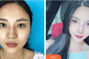 云南華美美萊美容醫(yī)院D.Sherman(舒曼)整形價(jià)格表附下瞼整形案例展示