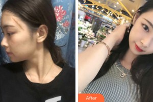 海南整形美容醫(yī)院馬文熙教授，整形價格表附皮膚美容案例展示