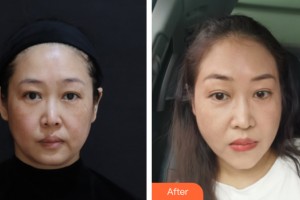 海南夢妮幻整形?？崎T診部何濤整形價格表附皮膚美容案例展示