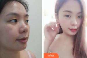 云南中醫(yī)學(xué)院附設(shè)中醫(yī)醫(yī)院整形美容中心李麗潔整形價(jià)格表附無針?biāo)獍咐故?>
</a>
<h3 class=