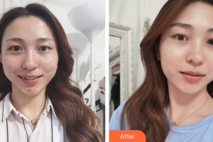 海南省皮膚病醫(yī)院激光整形美容中心王愛民整形價(jià)格表附皮膚美容案例展示