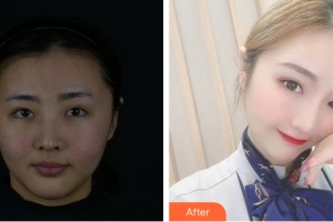 海南整形美容醫(yī)院李埰煐整形價(jià)格表附皮膚美容案例展示