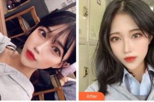 昆明吳氏嘉美美容醫(yī)院莊蔚強(qiáng)整形價(jià)格表附鼻部綜合案例展示