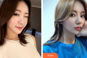 昆明前衛(wèi)美眼整形?？圃\所馮曉明整形價格表附鼻部綜合案例展示