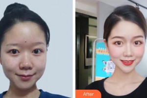 昆明皮膚病?？漆t(yī)院黃文標(biāo)整形價(jià)格表附激光祛斑案例展示