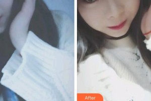 昆明皮膚病?？漆t(yī)院王正文整形價(jià)格表附眼部綜合案例展示