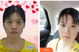 昆明康特森眼科醫(yī)院?jiǎn)掏蝺r(jià)格表附眼部綜合價(jià)格表