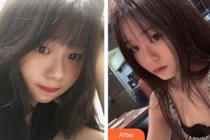 昆明康特森眼科醫(yī)院王慧整形價格表附眼部綜合案例展示