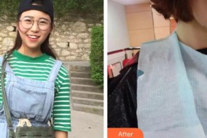 昆明拜博口腔醫(yī)院肖化云整形價格表附牙齒陶瓷矯正案例展示