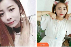 昆明德韓口腔醫(yī)院雷鳴整形價格表附金屬托槽矯正案例展示