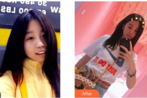 昆明德韓口腔醫(yī)院李琳娜整形價格表附自鎖托槽矯正案例展示