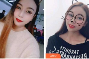 昆明拜博口腔醫(yī)院江忠蔓整形價格表附牙貼面案例展示