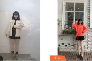 武漢五洲整形美容醫(yī)院孫孝先整形價(jià)格表附大腿吸脂案例展示