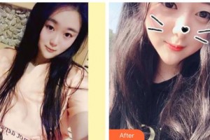 曲靖卓美口腔門診部李雪梅整形價(jià)格表附美白劑美白牙齒案例展示