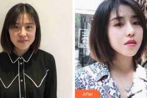 武漢麗臻醫(yī)療美容門診部石萍整形價格表附皮膚美容案例展示