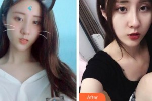 江蘇省人民醫(yī)院整形燒傷科周守貴整形價格表附激光祛斑案例展示